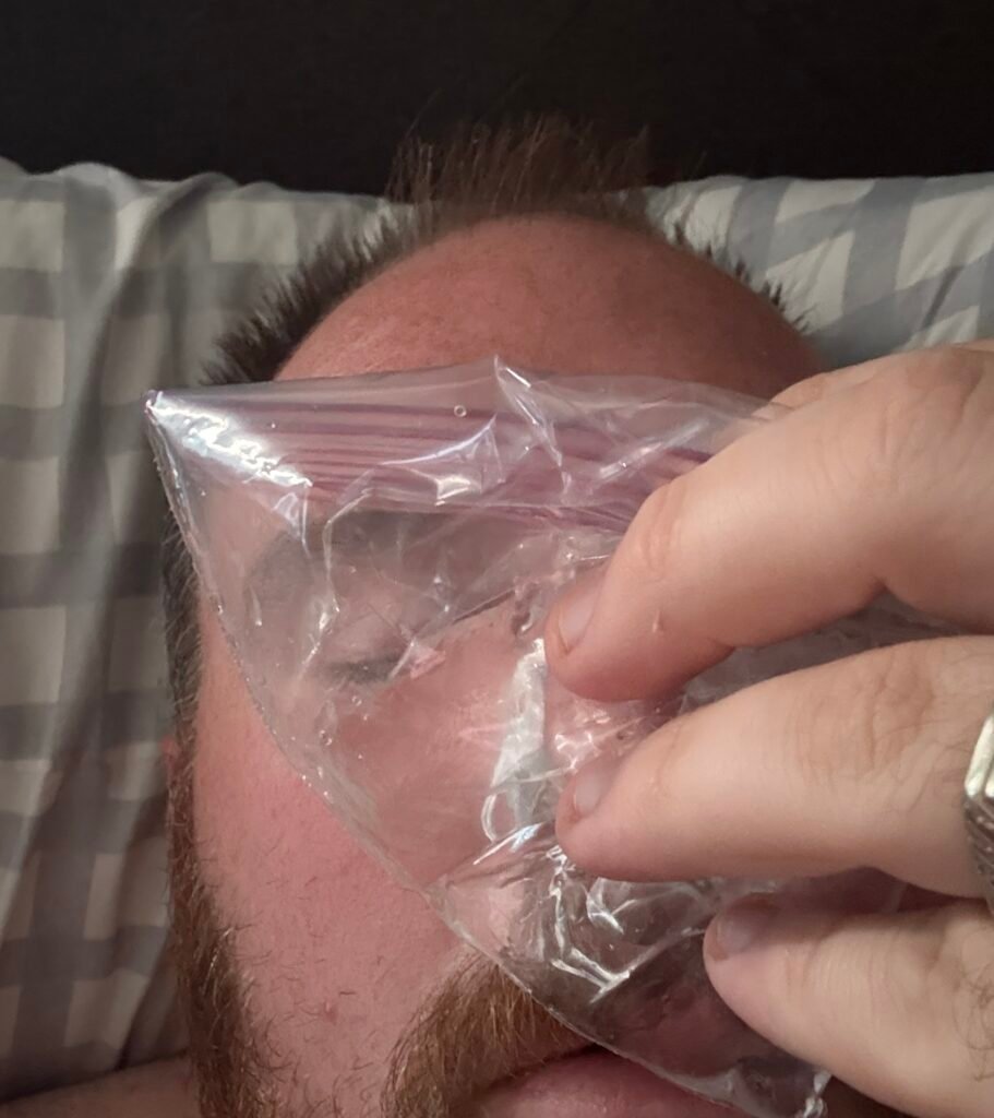 Using ice pack after defeated septum surgery 