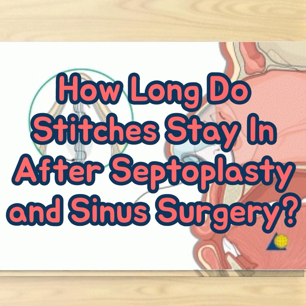 How Long Do Stitches Stay In After Septoplasty and Sinus Surgery
